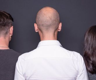 La consulta - Un mono con monóculo